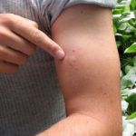 vitamina care ține țânțarii la distanță