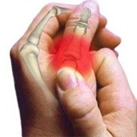 boala articulară masculină zgârie și durerile articulațiilor genunchiului ce trebuie făcut
