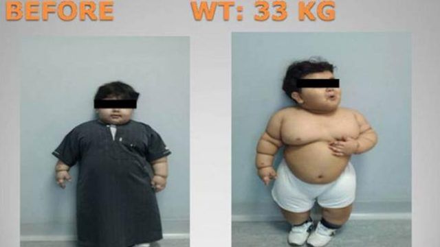 54 și trebuie să piardă în greutate am 38 de ani si nu pot slabi