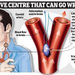 006_04S_CAROTID BODY
