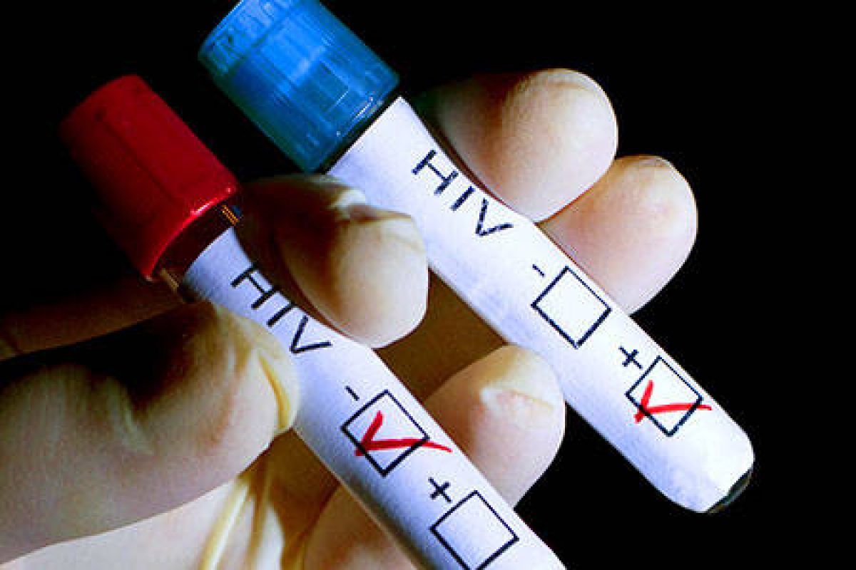 Primele simptome ale infectiei cu HIV, usor de confundat cu gripa - Farmacia DONA