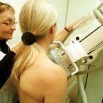 433085f  Breast Cancer Screening