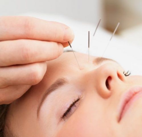 acupunctura ajuta la slabit