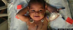 Lui Adonis i-au fost transplantate ficatul, pancreasul, stomacul şi cele două intestine, gros şi subţire.