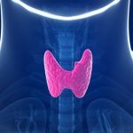 tiroida
