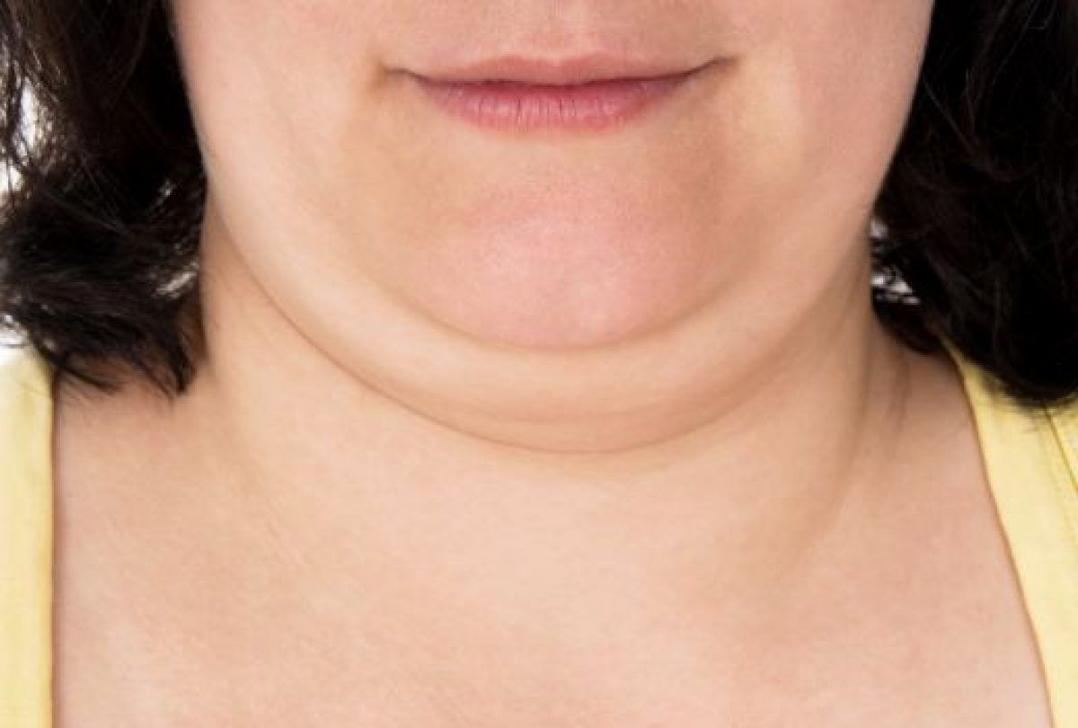 cum să ți pierzi grăsimea gâtului tehnici noi pentru pierderea în greutate