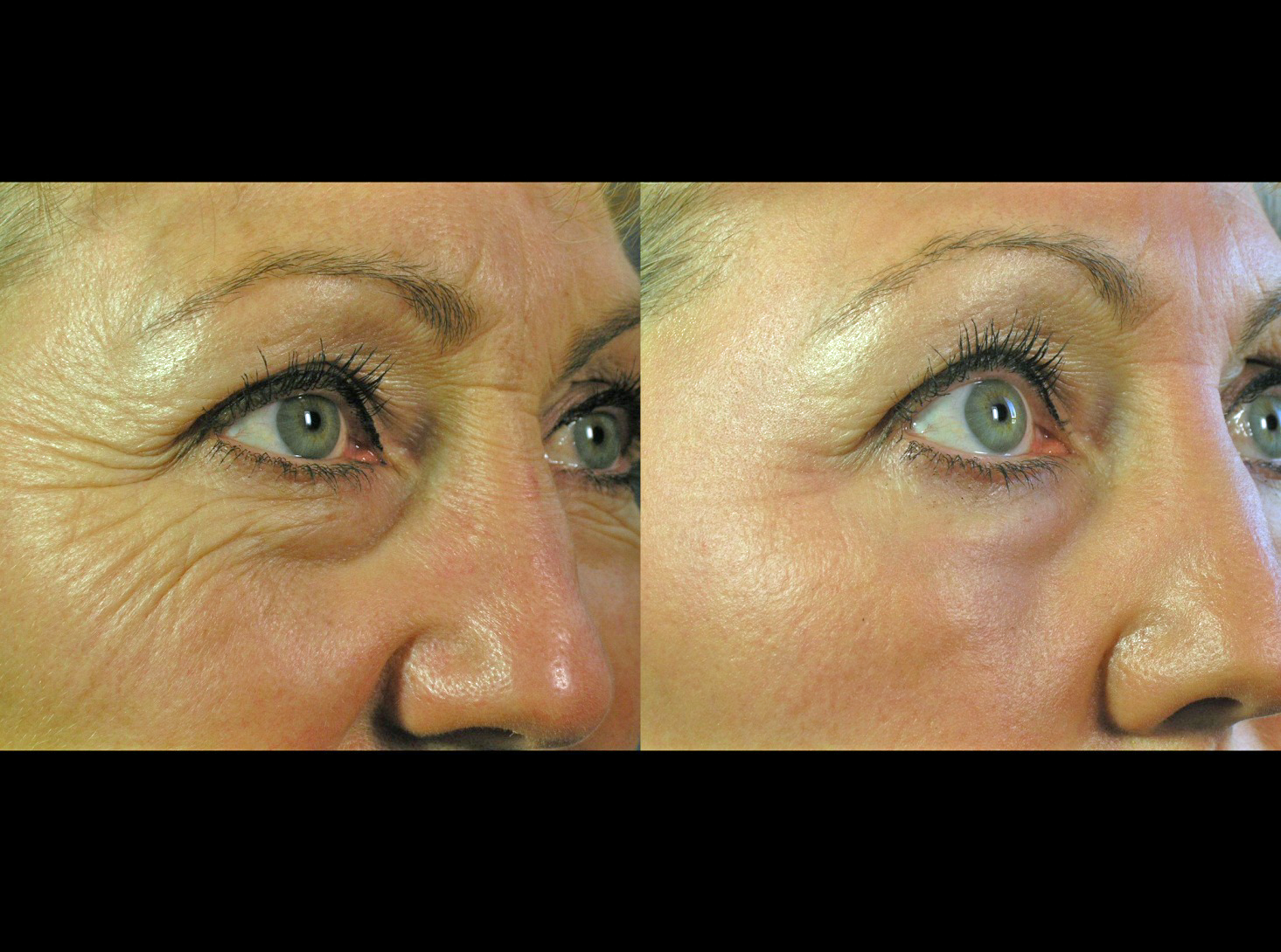Cosmetice anti aging: combaterea ridurilor și întinerirea tenului | iasengarden.ro