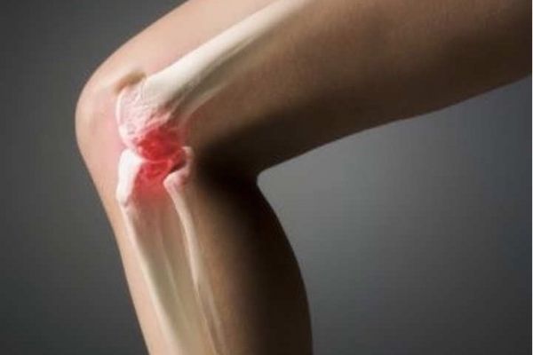 artrita genunchiului 1 și 2 grade