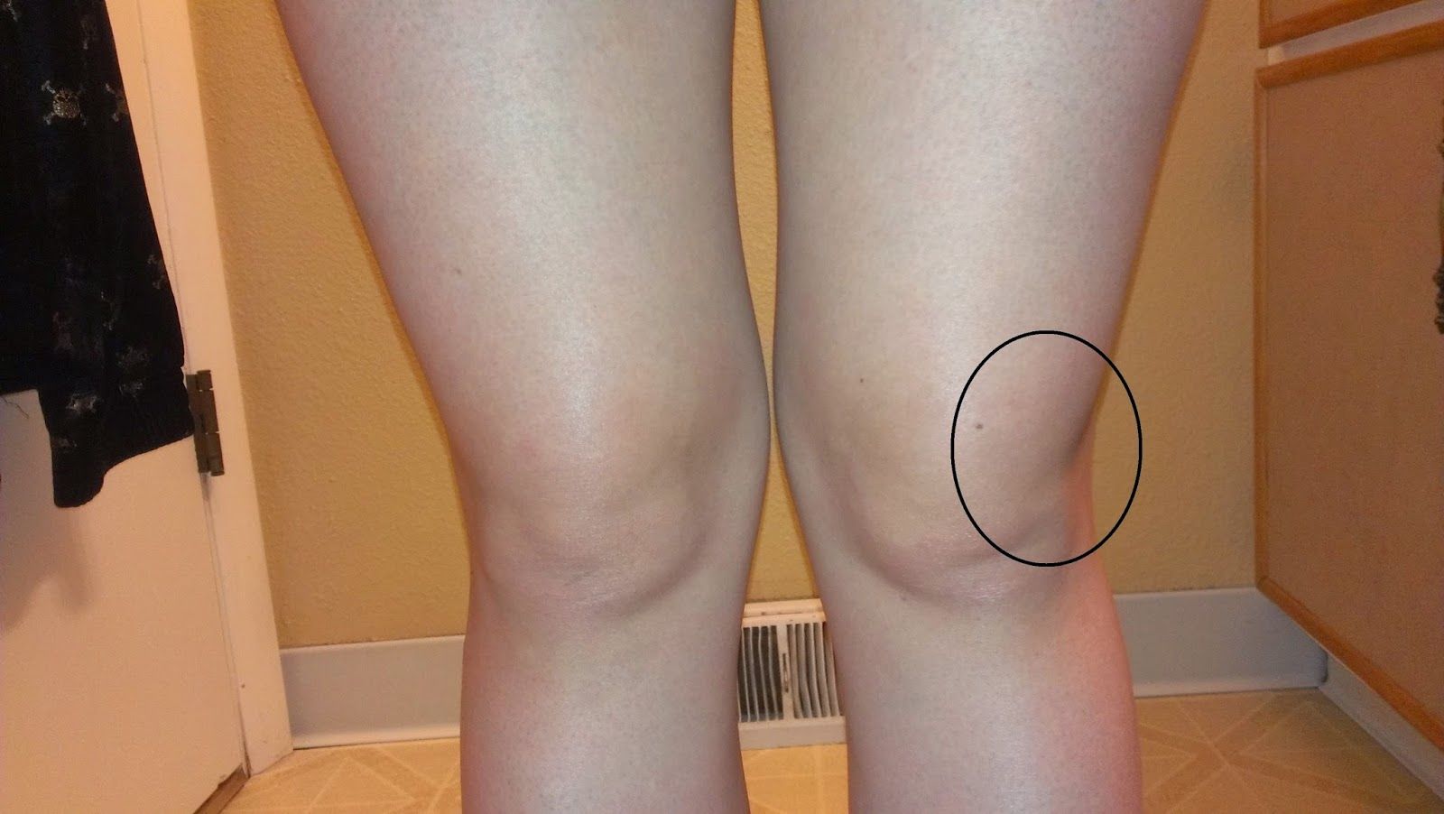 Fiziopatologia articulatiei genunchiului – privire de sinteza