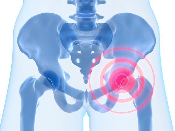 artroza necrovertebrală a coloanei cervicale și tratamentul