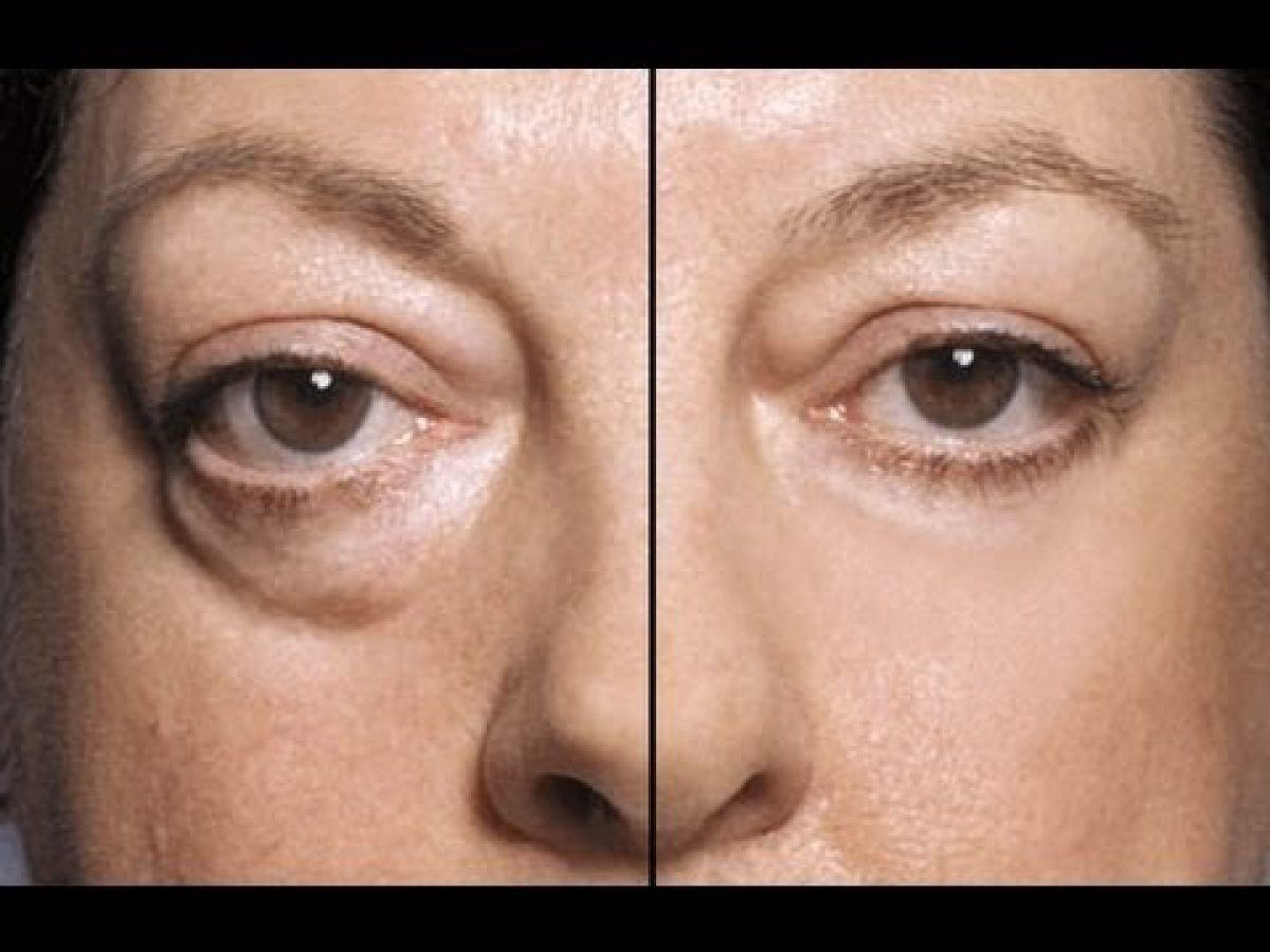 it cosmetics bye roșeață anti îmbătrânire crema de fata buna 40 ani