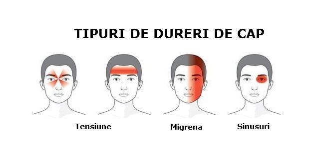 dureri dupa cap tensiune)