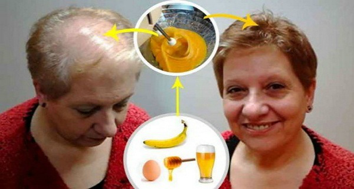 Cea mai buna solutie pentru cresterea parului