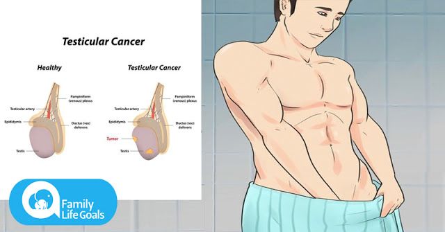 Autoexaminarea testiculara