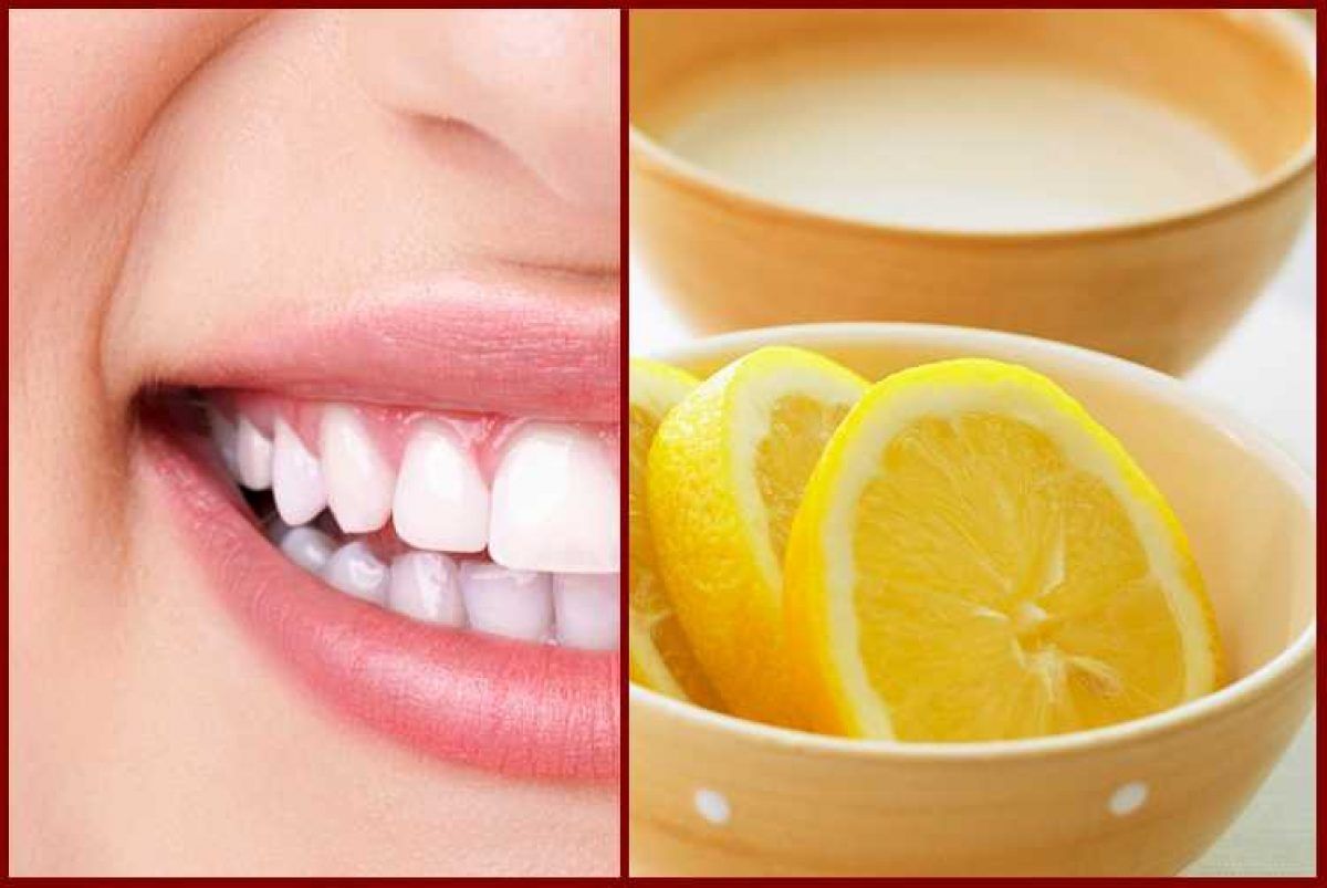 Зубы желтый чистить. Отбеливание зубов содой. Лимонная для зубов. Отбеливание зубов лимоном.