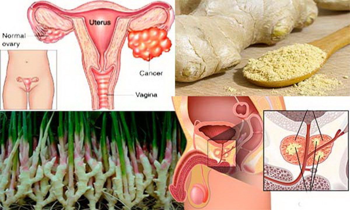 Ghimbir cu miere si lamaie pentru cancer