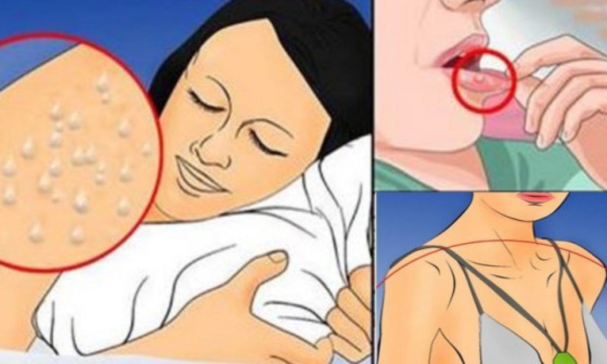 10 simptome ale infecției cu HIV. Atenție la dureri de cap, oboseală și iritații ale pielii