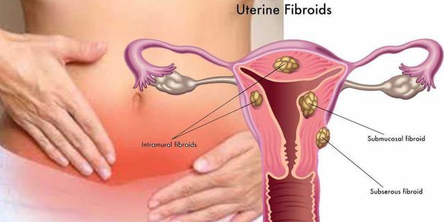 Frecvența urinării înainte de menstruație - Sângerare