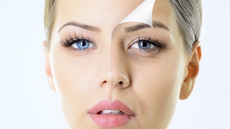 Cum se elimină ridurile de sub ochi și ce cauzează apariția?