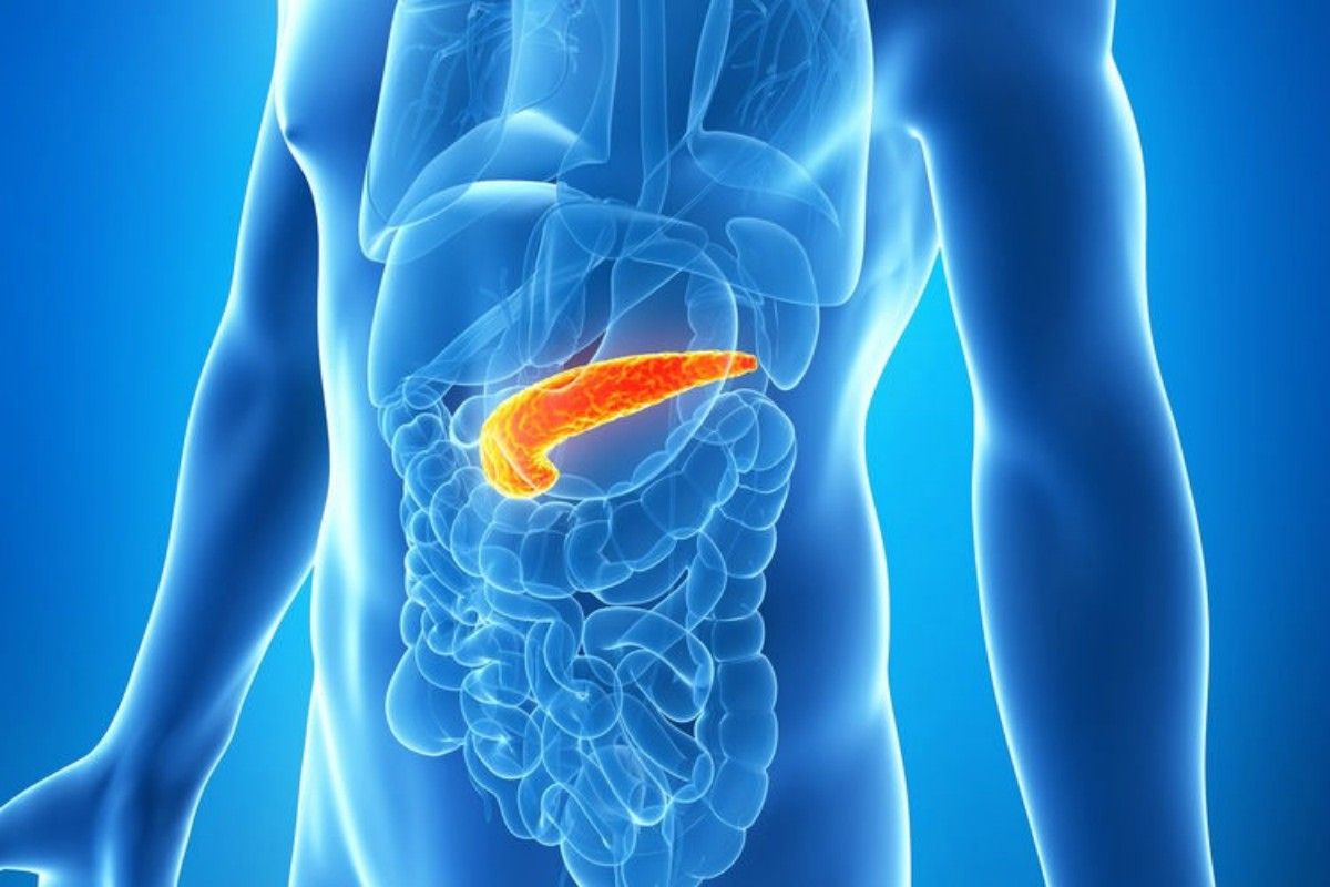 Pancreatita Acuta si Cronica: Simptome, complicatii, tratament | castigacualexandrion.ro