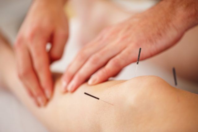 acupunctura pentru dureri de genunchi)