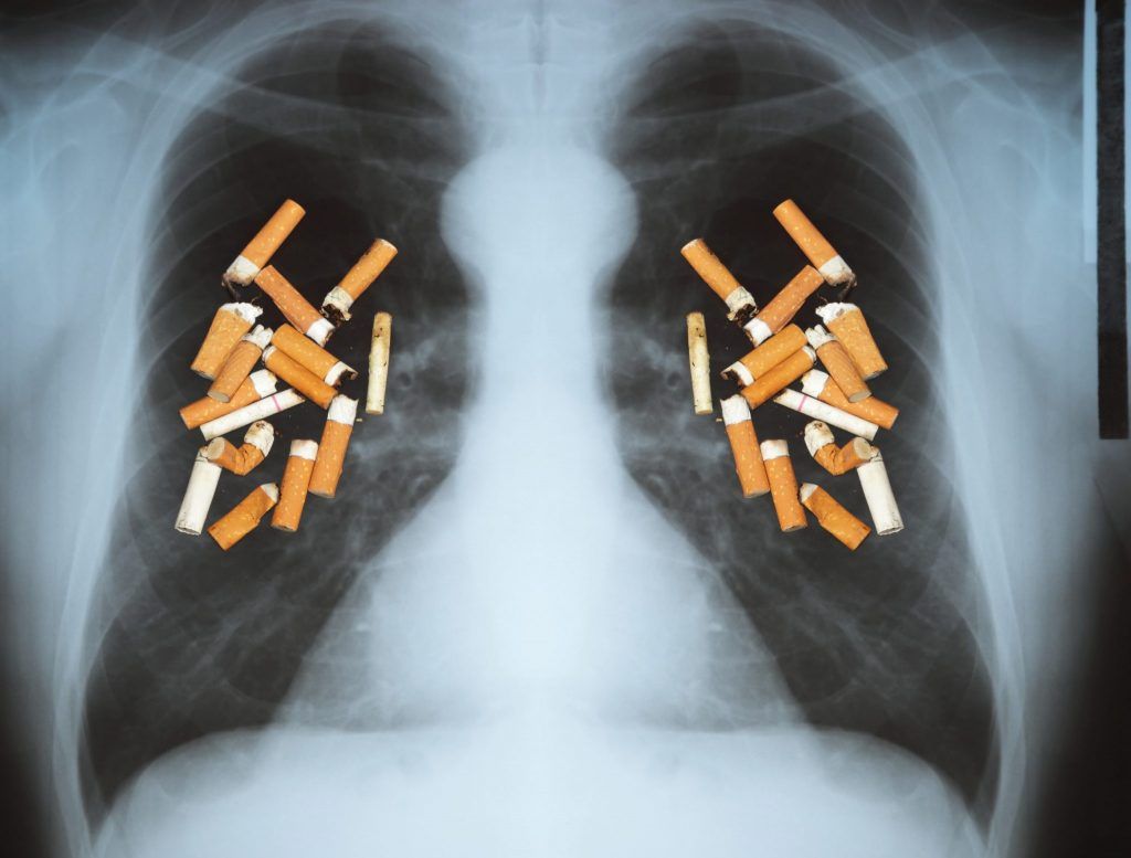 Fumatul, cauză a cancerului pulmonar
