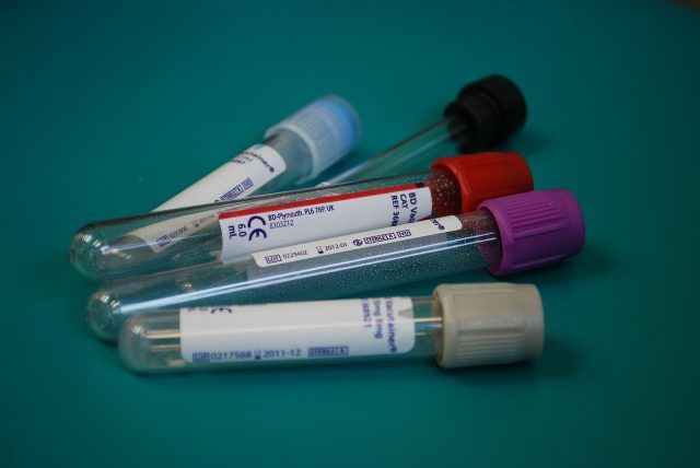 loteria analizelor medicale