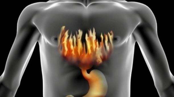 Simptome reflux gastroesofagian