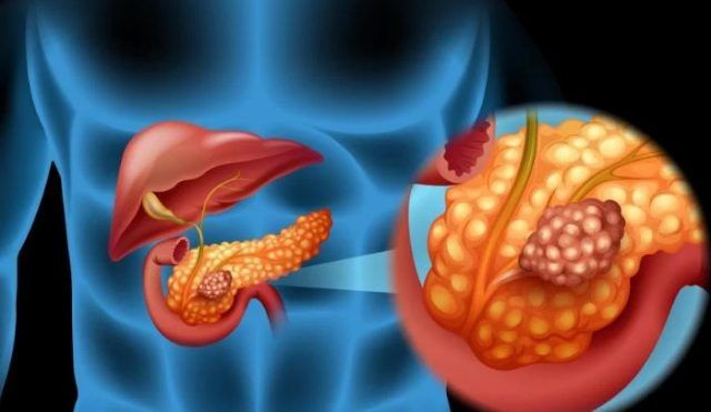vaporizator de arzător de grăsime poți să pierzi în greutate în menopauză