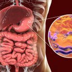 helicobacter pylori 2