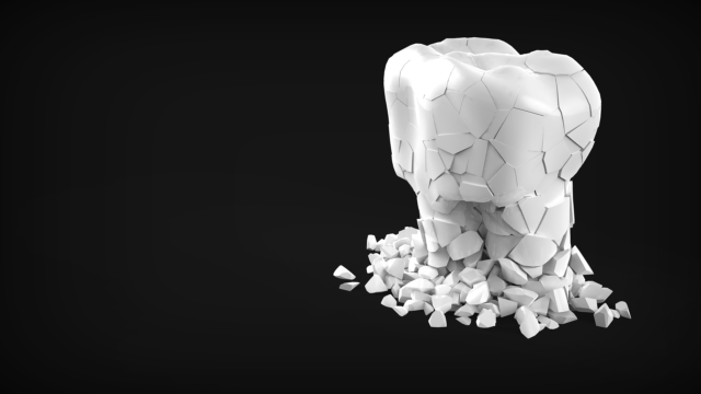 dentare
