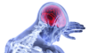 brain tumors
