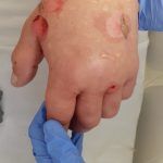 povestea socanta pacienti covid 2