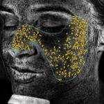 VISIA-card-uv-spots-Statera