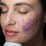 Visia-card-pori-Statera