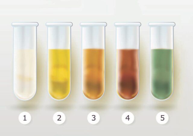 culoarea urinei prostatitei cronice)