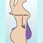 Burta „hormonală”