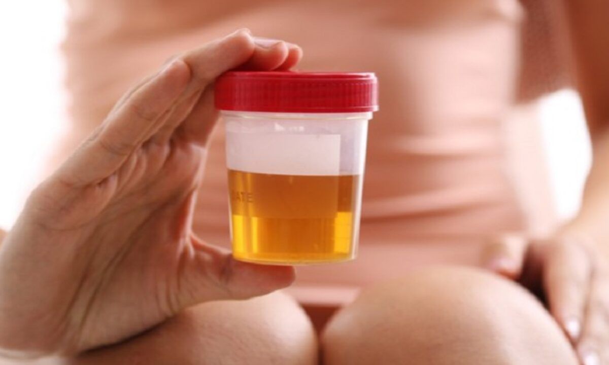 prostatită cronică urină tulbure