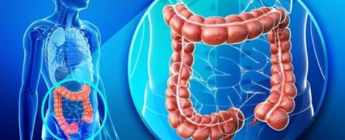 Cancer colorectal: a doua cauză de deces dintre toate tipurile de cancer