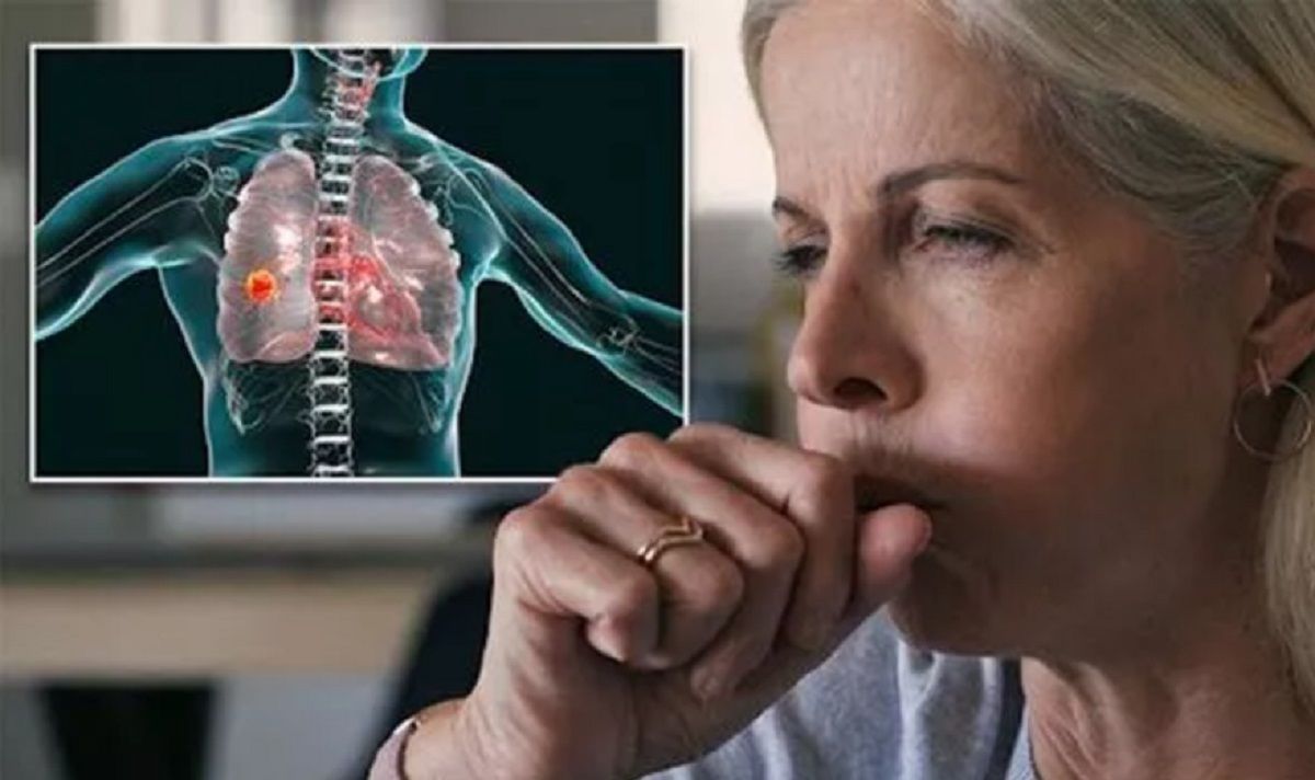 semne ale cancerului pulmonar