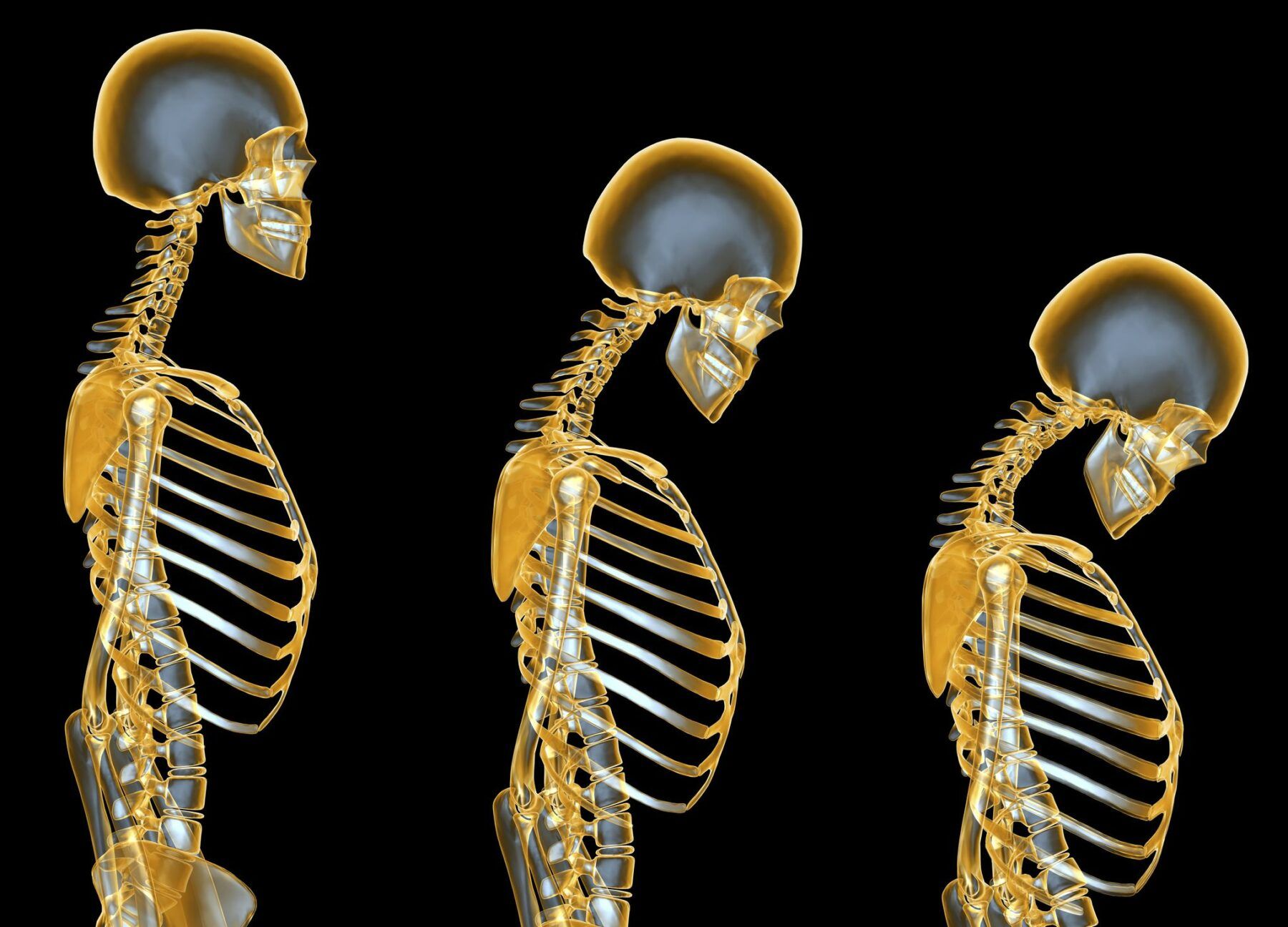 Obicei care duce la osteoporoza