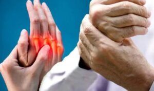 mituri artrită