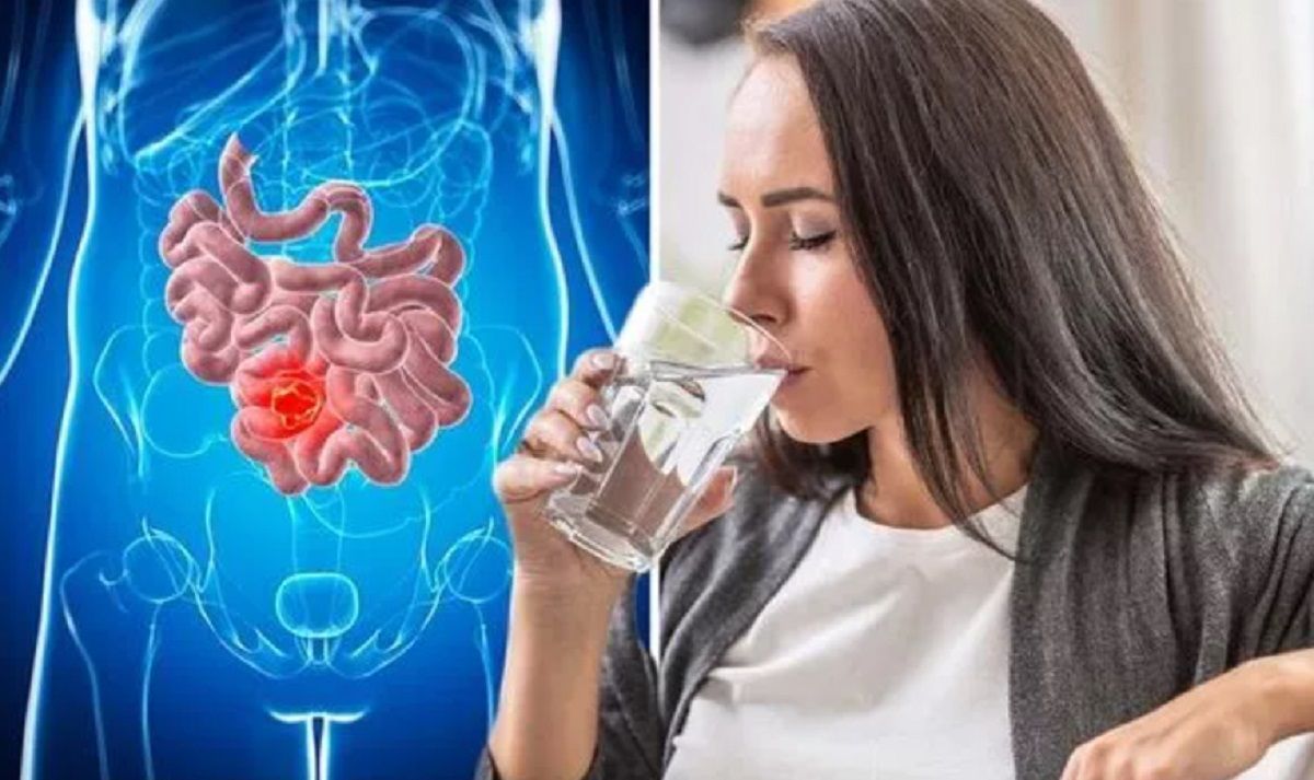 Crohn este o tulburare inflamatorie cronică a tractului