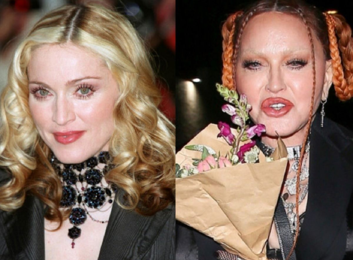 Madonna