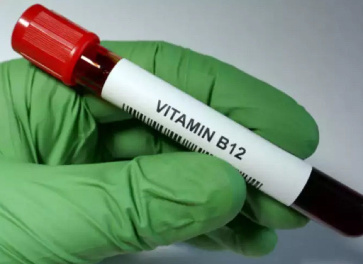 analize vitamina b12