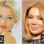 gina-pistol operatii estetice