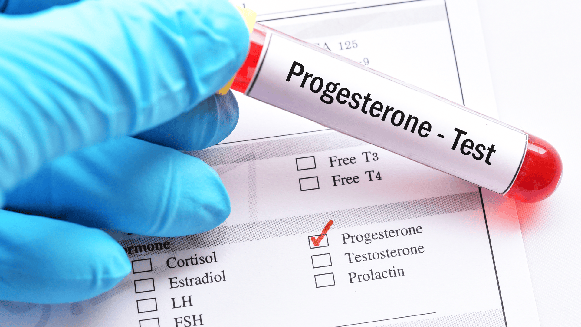 Analiza medical progesteron