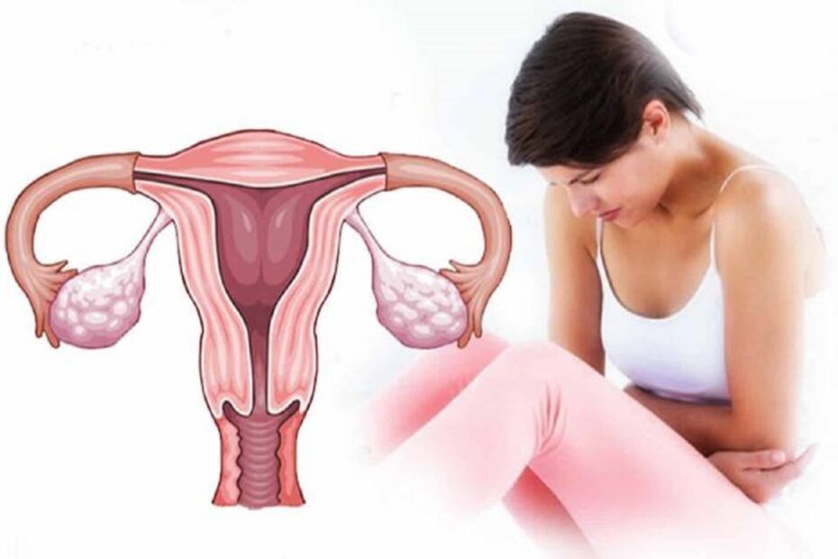 cancer de col uterin