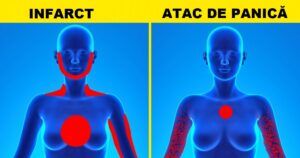 Atac de cord VS atac de panică