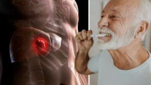 boala ficatului gras sangerari gingivale